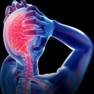 Migrena - Istine i zablude