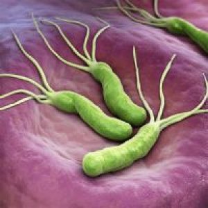 Helicobacter pylori i izvanželučane manifestacije